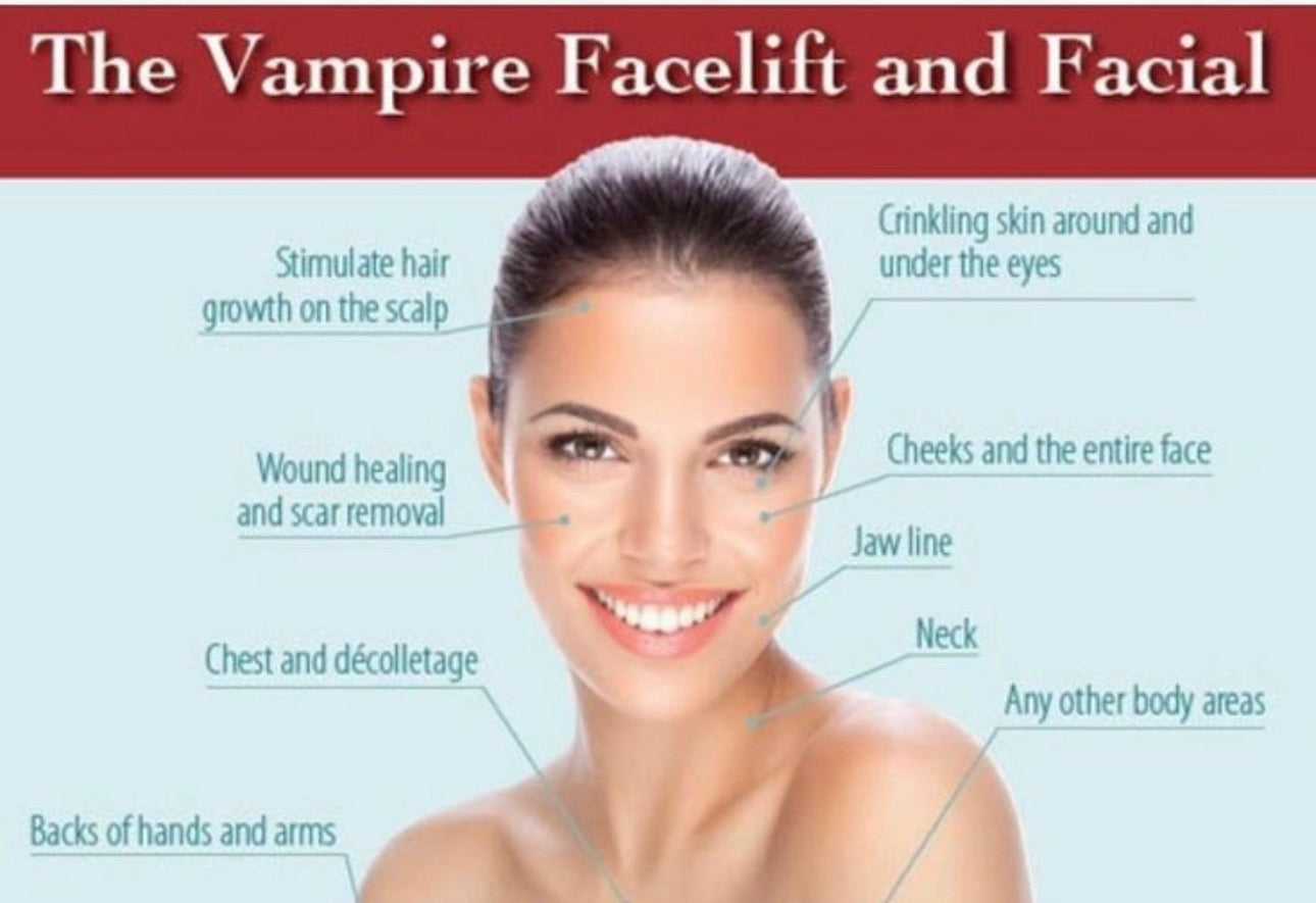Vampire Facial $850